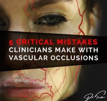 5 Critical Mistakes Clinicians Make With Vascular Occlusions