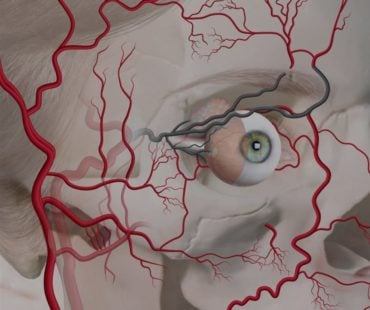 Blindness; The Worst Filler Complication