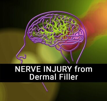 Nerve Injury caused by Dermal Filler