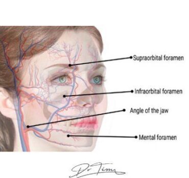 13-point-plan to reduce the risk of vascular necrosis 