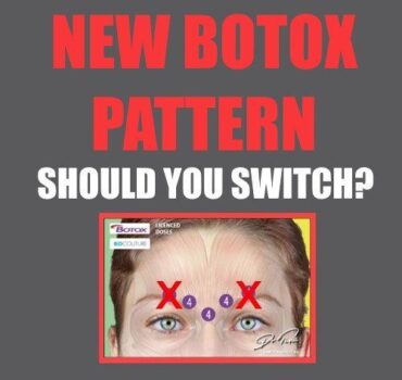 New BOTOX® Pattern – Should You Switch?