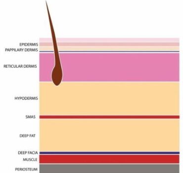 Best Needle Injection Depth for Dermal Fillers