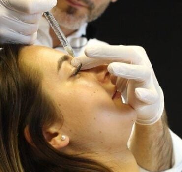 Non-surgical rhinoplasty: do not inject this type of nose!
