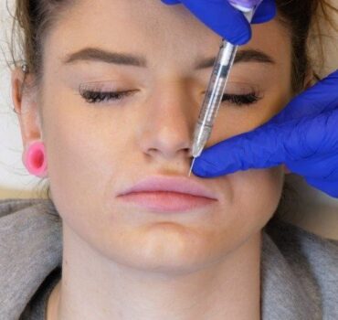 Heart-shaped, keyhole and Devil lips: good or bad lip filler trends?
