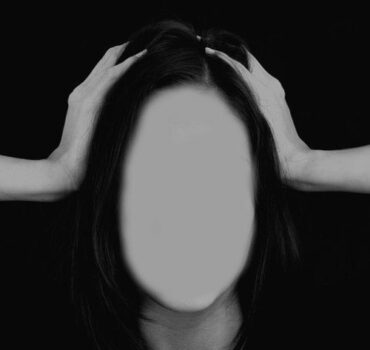 Does hyaluronidase dissolve natural tissue and ruin faces?