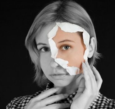 Baby Botox and preventative botulinum toxin treatments explained