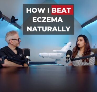 Longevity: “I beat eczema by ditching steroid creams and healing my gut”