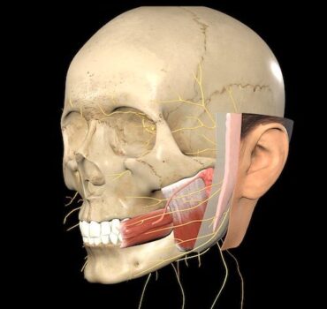Mastering Masseter Botox: A Guide for Aesthetic Injectors
