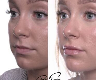 The Lip Assessment Guide