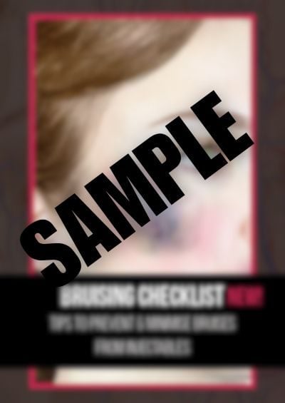 Bruising-Checklist-Sample