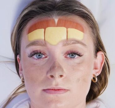 How to Learn Facial Anatomy for Injectors
