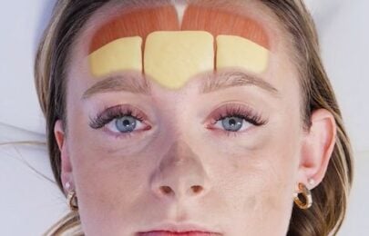 How to Learn Facial Anatomy for Injectors