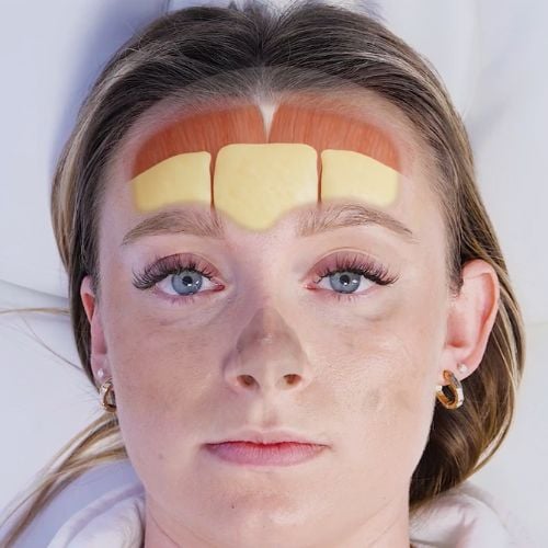How to Learn Facial Anatomy for Injectors