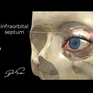 Infraorbital septum