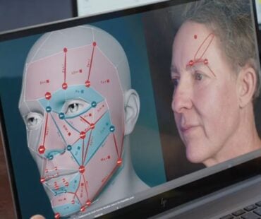 Why Treating A Downturned Mouth in Isolation Fails