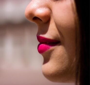 Why Nasolabial Fold Treatments Look Unnatural