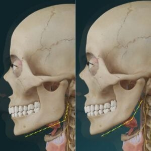 skull change anatomy