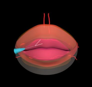 Understanding the Role of the Orbicularis Oris in Lip Form