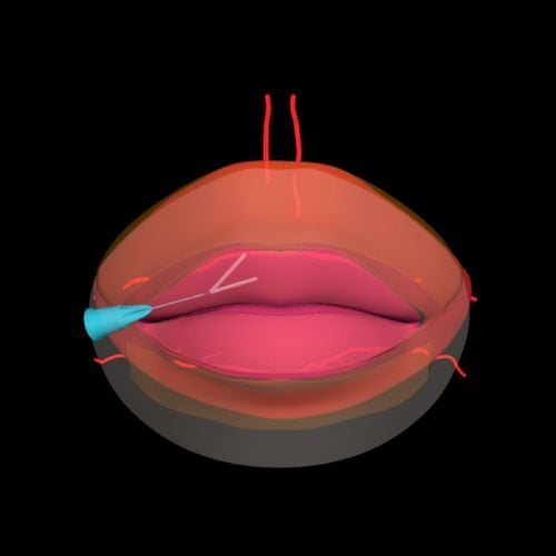Understanding the Role of the Orbicularis Oris in Lip Form