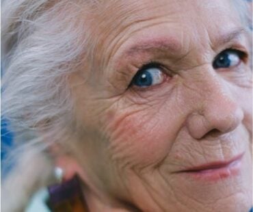 The Ageing Lip – Anatomy & Process