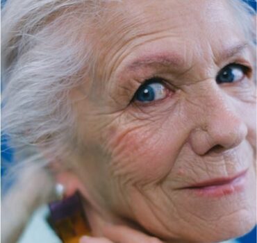 The Ageing Lip – Anatomy & Process