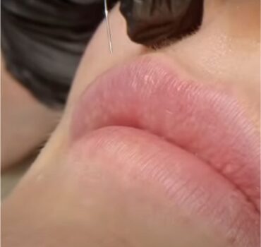 Lip Injection Depth and Anatomy Guide: Small Lips