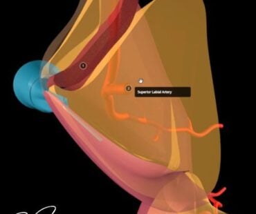 Where’s the Artery? Mastering 3D Lip Anatomy for Safer Injections