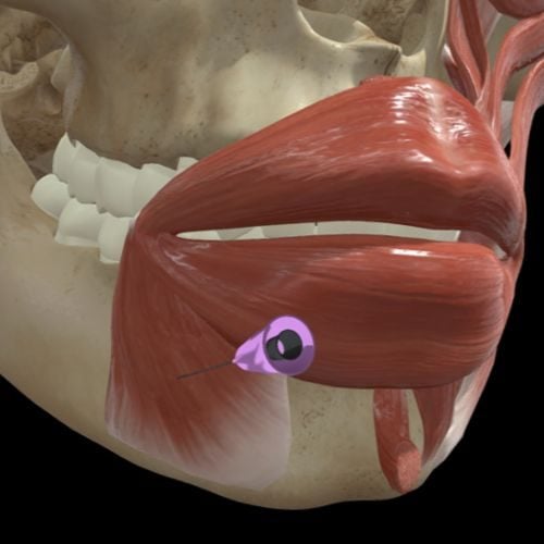 Depressor Anguli Oris (DAO) Treatment: How Relaxing This Muscle Lifts the Lower Face