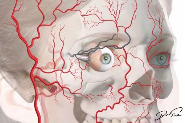 Anatomical illustration of facial blood vessel network showing arterial patterns aesthetic injectors must understand to prevent vascular occlusion