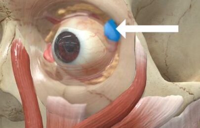 Avoiding Botox Eye Complications From Dry Eye to the ‘Psycho Look’