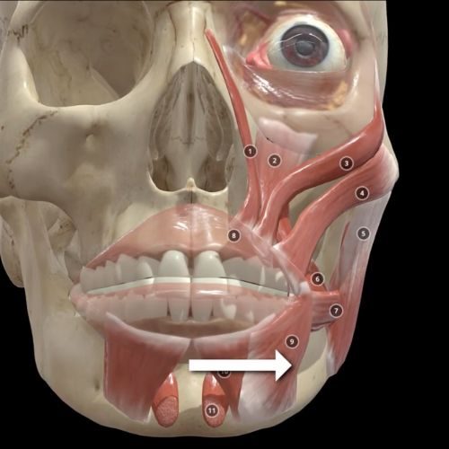 Depressor anguli oris muscle anatomy showing lateral injection technique to avoid depressor labii muscle overlap in Botox treatment