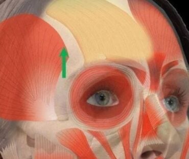 Understanding the SNARE Complex: The True Target of Botulinum Toxin