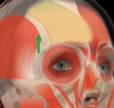 Understanding the SNARE Complex: The True Target of Botulinum Toxin