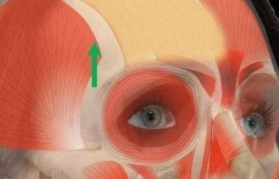 Understanding the SNARE Complex: The True Target of Botulinum Toxin