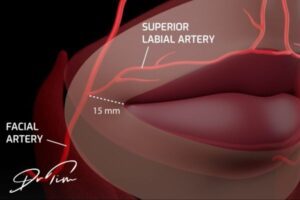 3D lip anatomy showing superior labial artery position