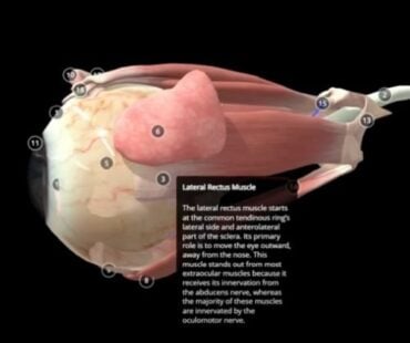 Preventing Double Vision from Botox: Mastering the Lateral Rectus Safety Zone