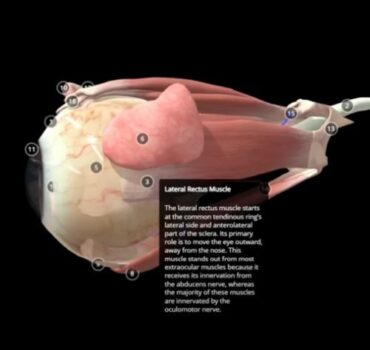 Preventing Double Vision from Botox: Mastering the Lateral Rectus Safety Zone