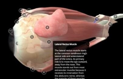 Preventing Double Vision from Botox: Mastering the Lateral Rectus Safety Zone
