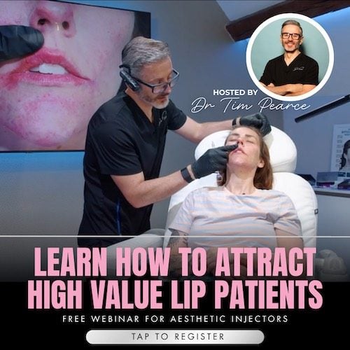 8d lips - high value lip fillers 8d lips - high value lip fillers