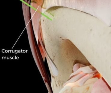 Why injection depth matters more than avoiding the eyelid
