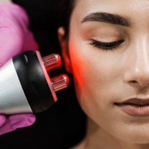 radiofrequency skin tightening