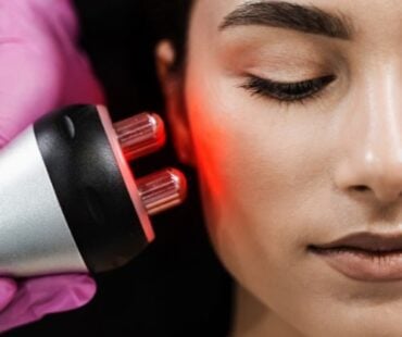 Radiofrequency – The Science of Skin Tightening