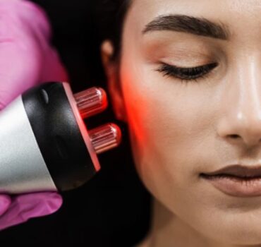 Radiofrequency – The Science of Skin Tightening