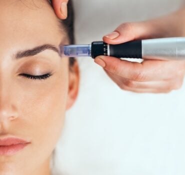 The Science Behind Microneedling: Are We Seeing A True Regeneration?