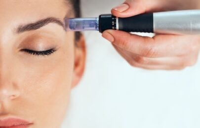 The Science Behind Microneedling: Are We Seeing A True Regeneration?