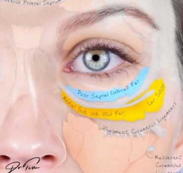Upgrading Your Injection Confidence Through Facial Muscle Anatomy