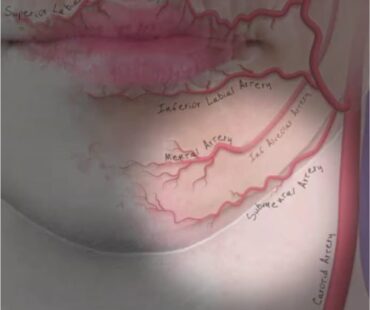 Understanding Lip and Lower Face Anatomy: The Foundation for Safe Injectable Treatment