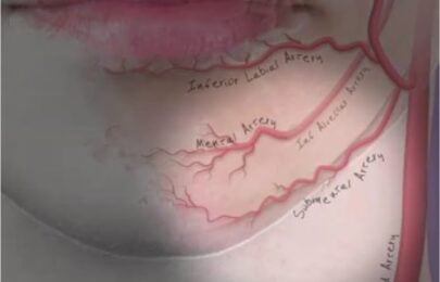 Understanding Lip and Lower Face Anatomy: The Foundation for Safe Injectable Treatment