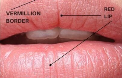 3D Lip Anatomy: Why Millimeter Precision Prevents Vascular Occlusion