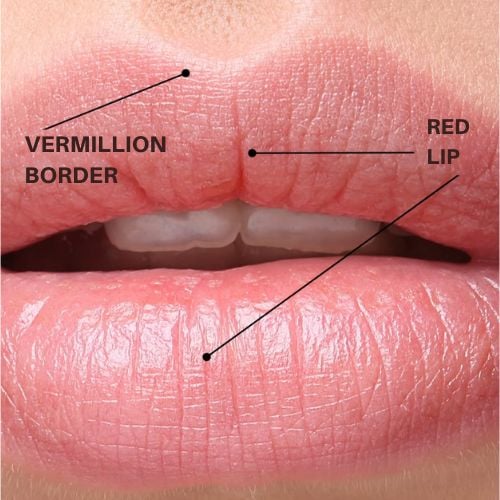3D Lip Anatomy: Why Millimeter Precision Prevents Vascular Occlusion